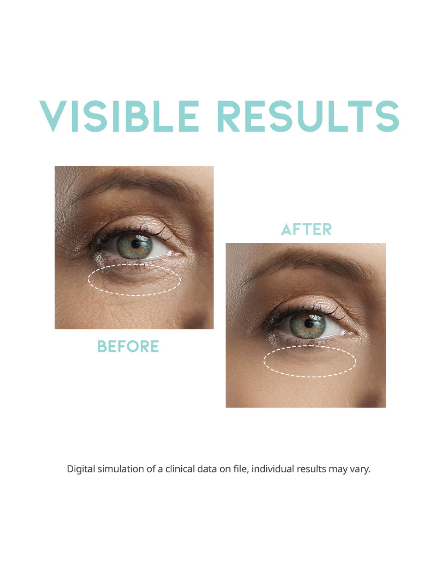 OOTD Wrinkle Lift Eye Serum 30g