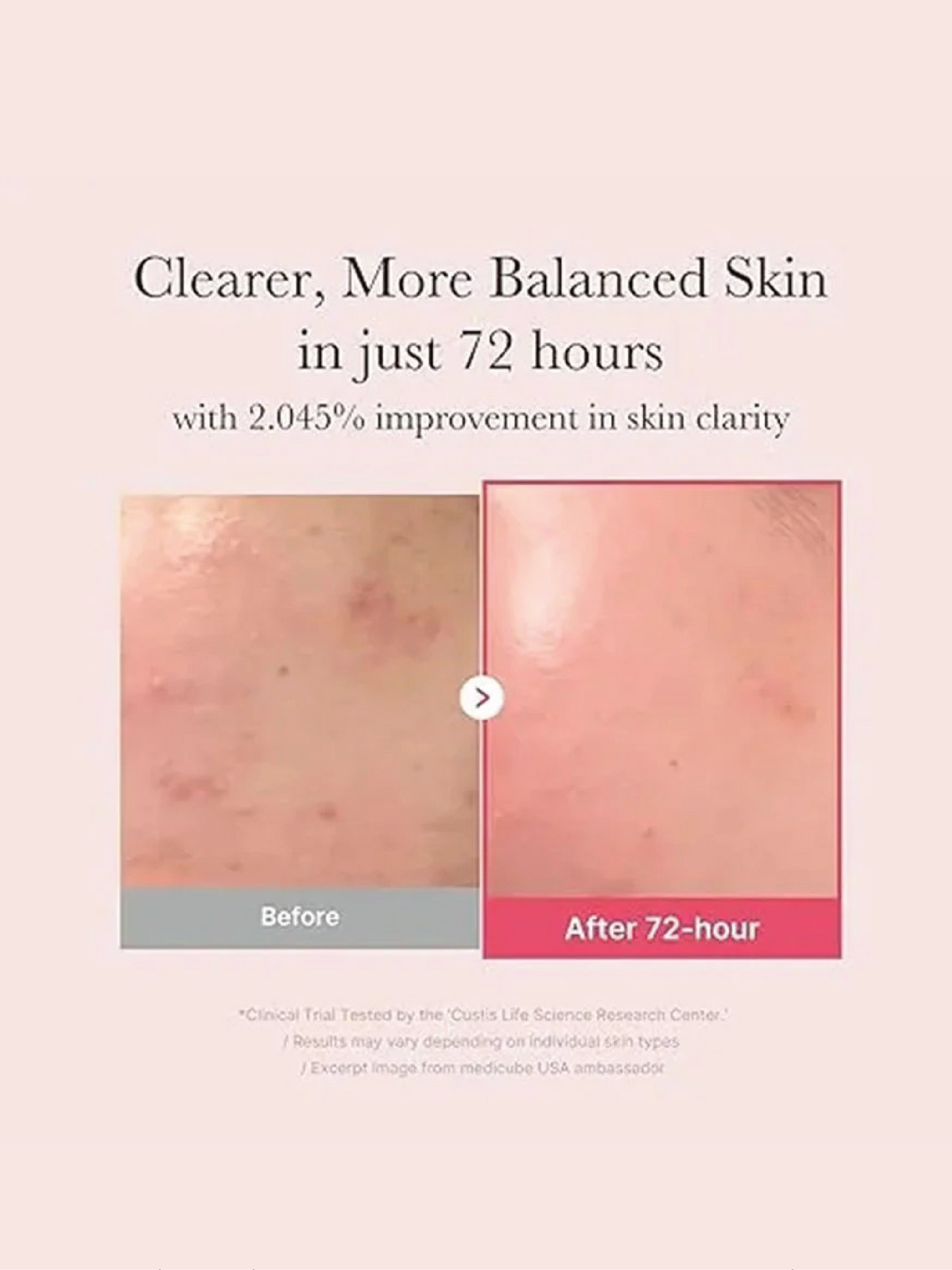 MEDICUBE TXA Niacinamide 15 Serum 30ml