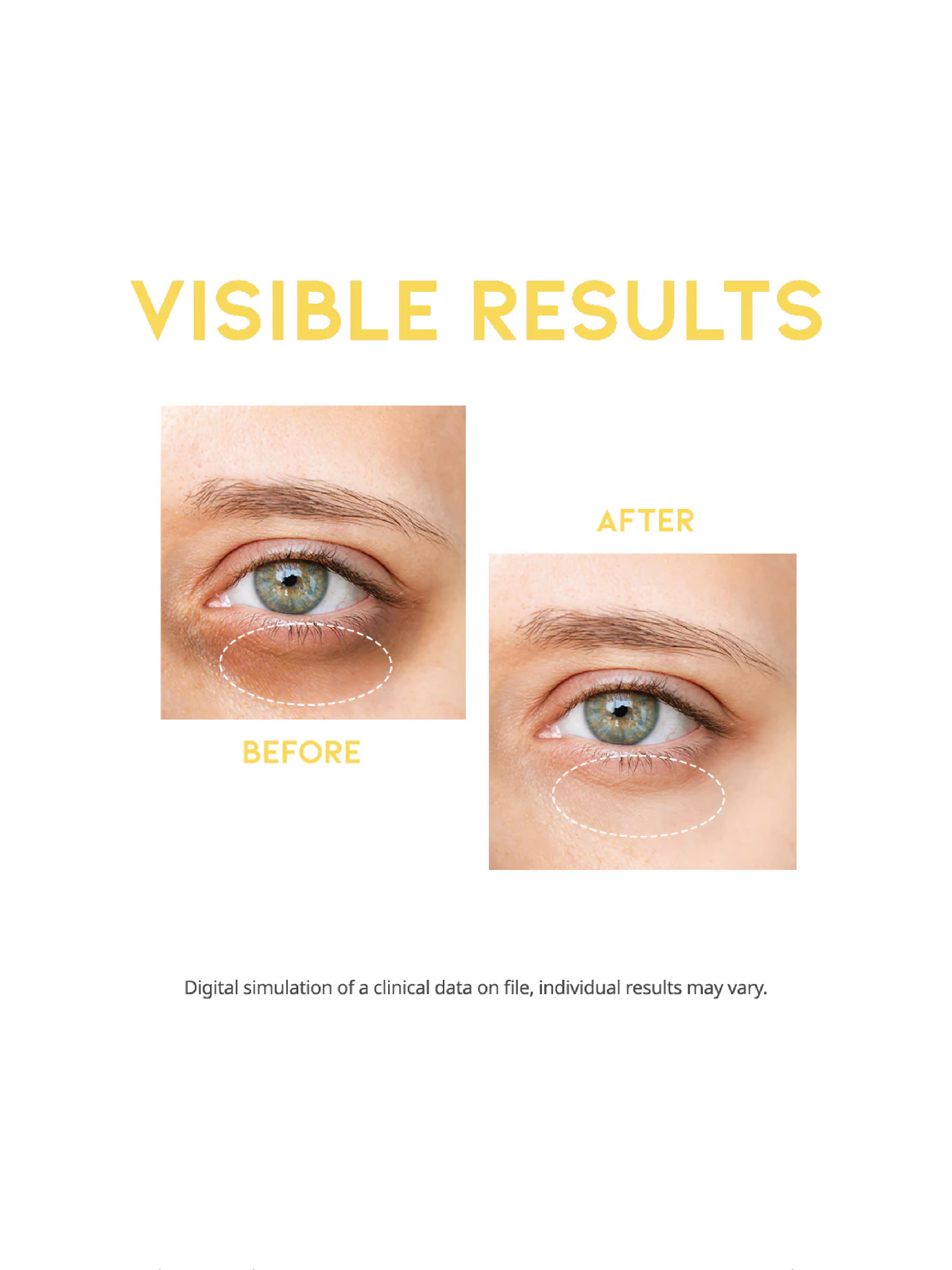 Sérum Contour des Yeux Anti-Cernes OOTD 30g