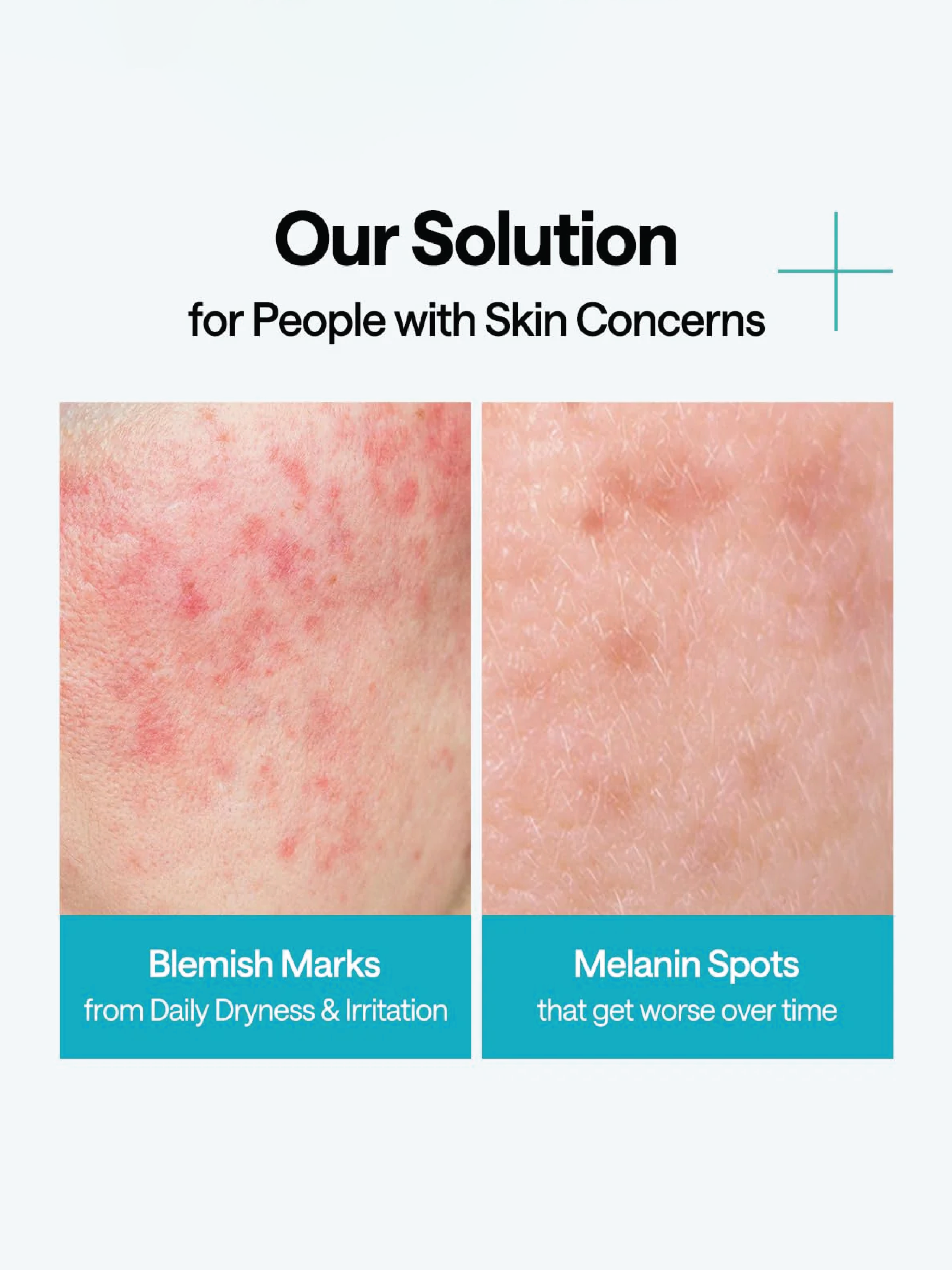Masque-Sérum Enveloppant au Madécassoside MEDIHEAL (10)