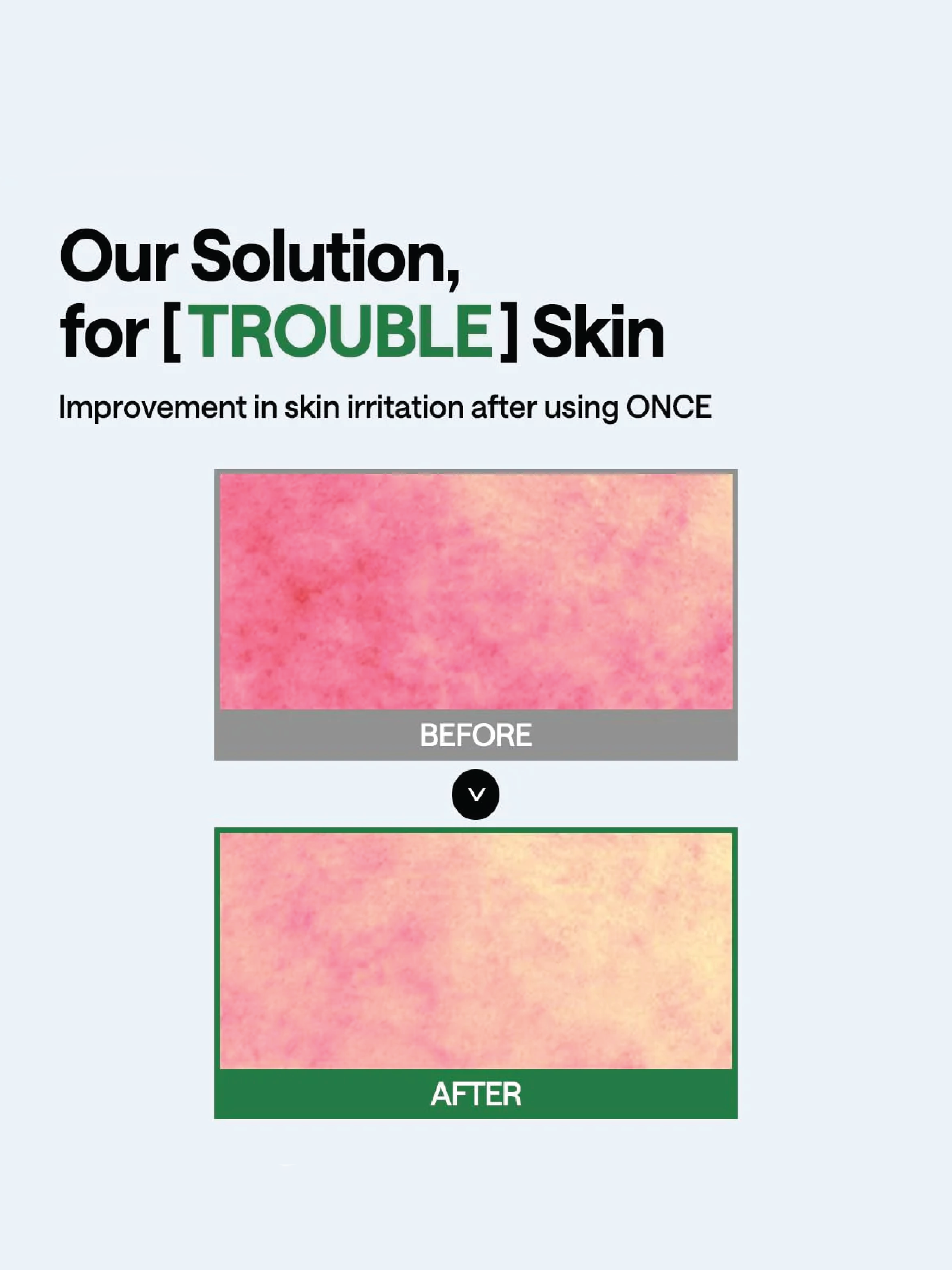 MEDIHEAL Masque-sérum enveloppant à l'arbre à thé (10)