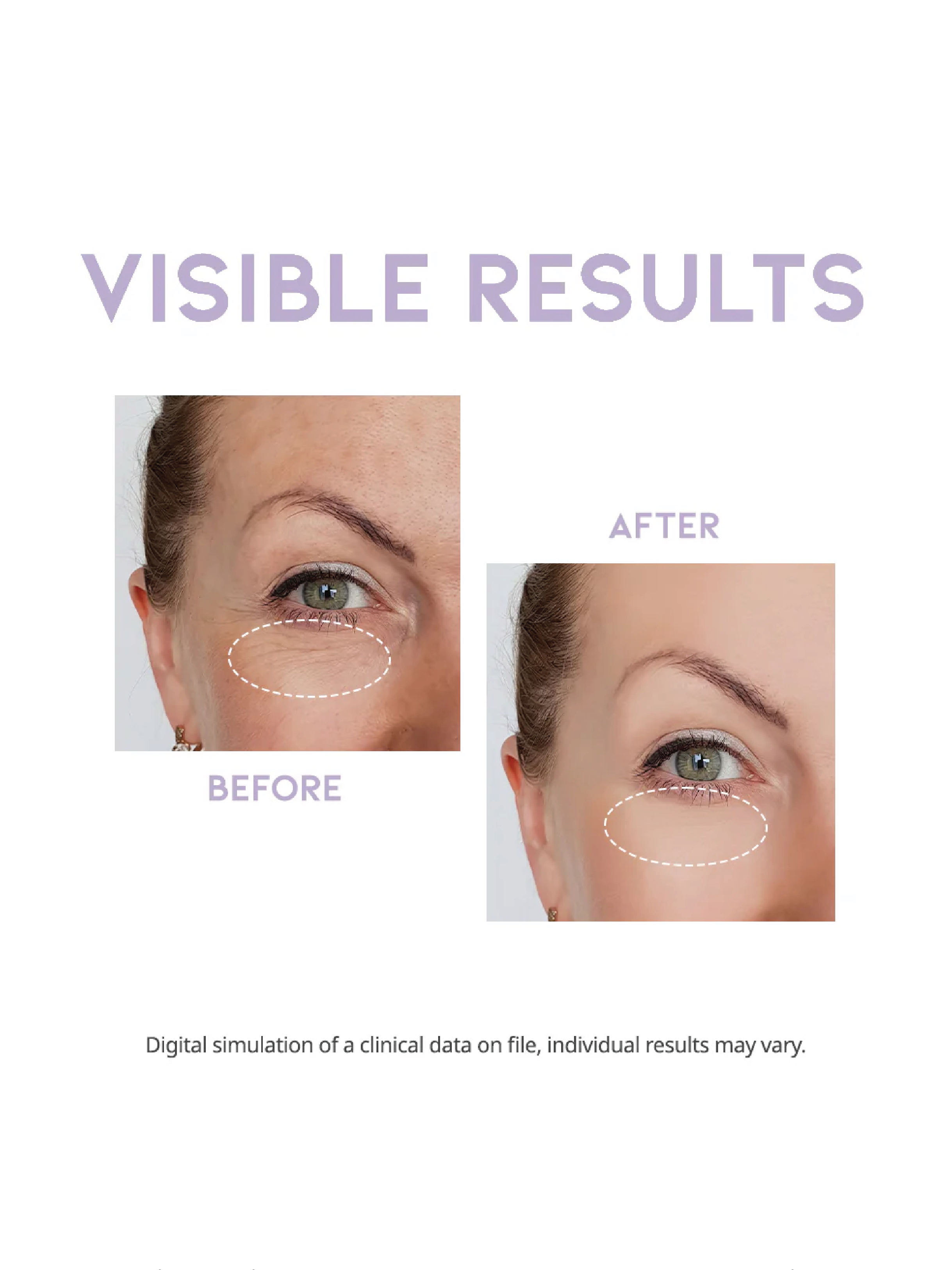 OOTD Crème de nuit contour des yeux 25g