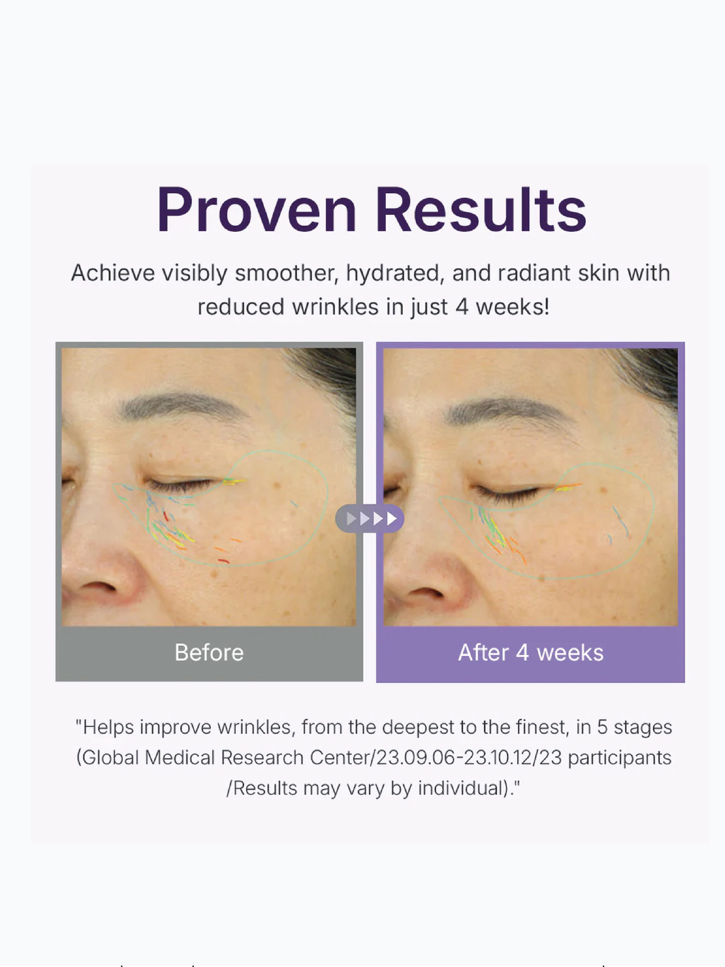 CENTELLIAN24 360 Shot PDRN Active Serum 50ml