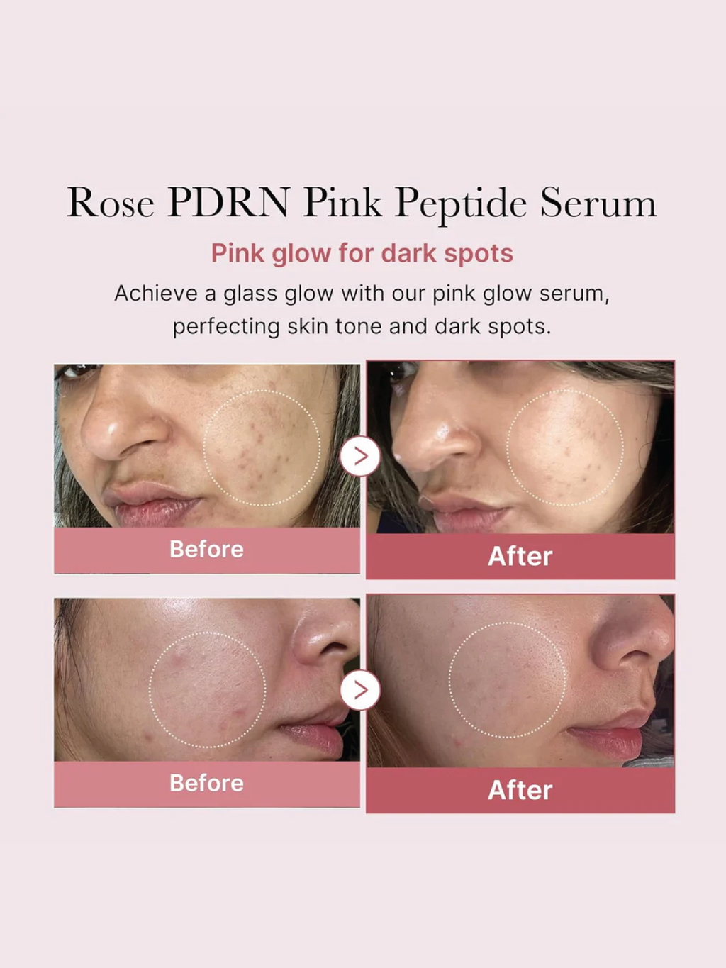 MEDICUBE PDRN Sérum Peptides Roses 30ml