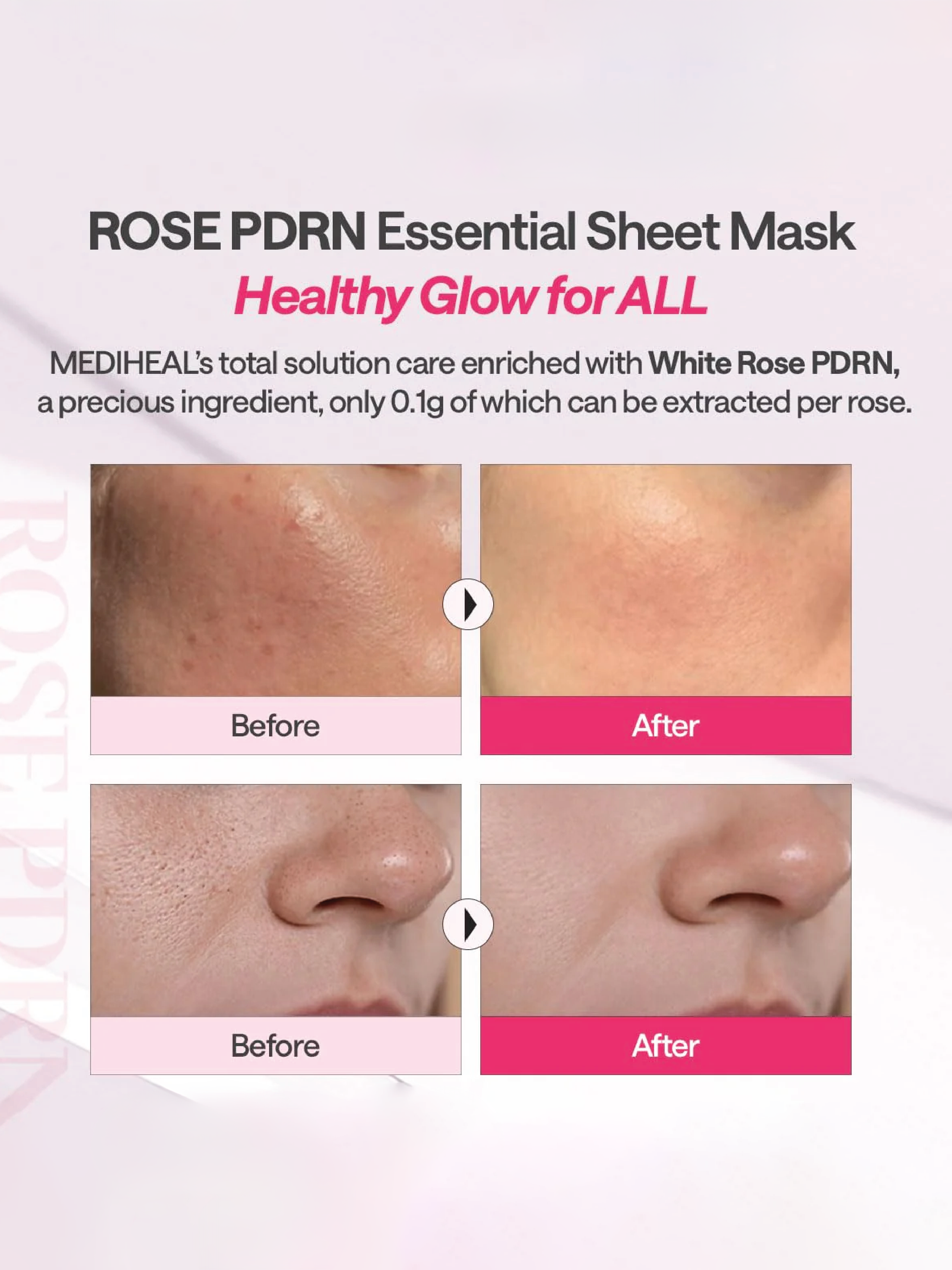 Masque Essentiel à la Rose PDRN MEDIHEAL (10 pièces)