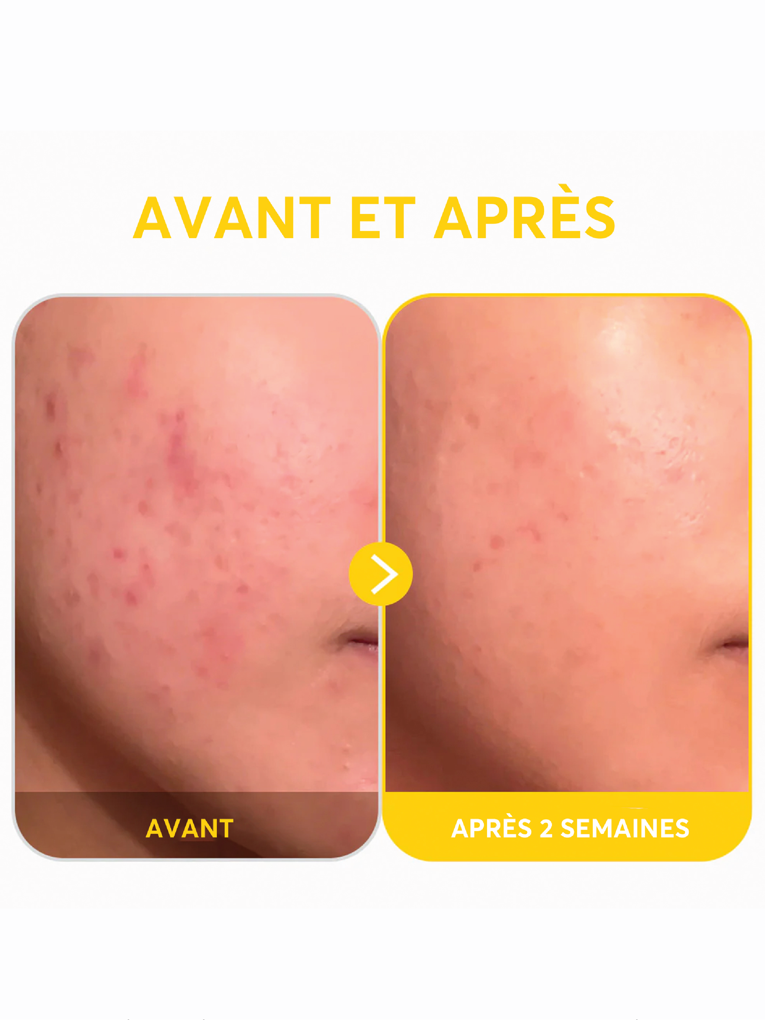 TIRTIR Pure Vitamin C24 Serum 30ml